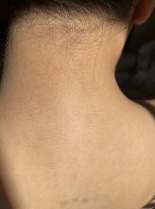 施術はほとんど痛みはほとんどありませんでした ルミクス脱毛サロン ラココ 岡山ロッツ店 岡山県 ルミクス脱毛口コミ体験談