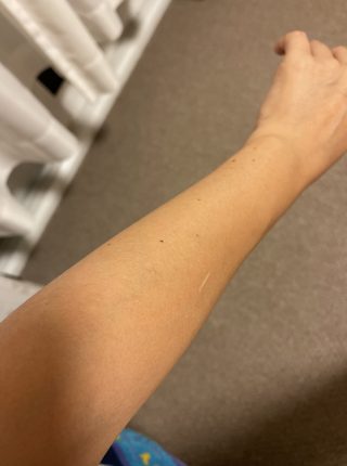 ルミクス脱毛では日焼けした肌でも脱毛できる ルミクス脱毛サロン ラココ銀座本店 東京都 ルミクス脱毛口コミ体験談